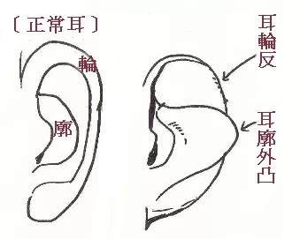 耳輪耳朵面相女|解析面相中的反廓耳